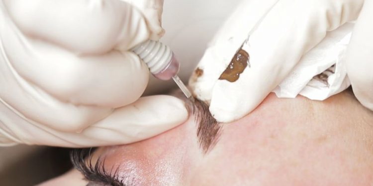 میکروبلیدینگ چیست؟