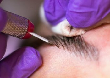 نقش انواع پوست برای انجام فیبروز ابرو