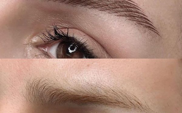 نحوه شستن صورت بعد از فیبروز ابرو و مدت زمان بهبود زخم فیبروز