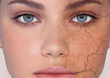 خشکی پوست در زمستان