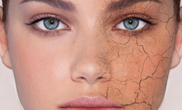 خشکی پوست در زمستان