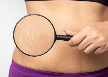 ترک پوستی چیست؟