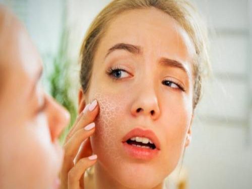 آنچه در مورد پوست خشک باید بدانید