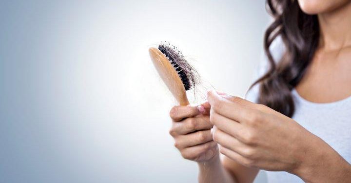 ریزش موی ارثی چیست و چگونگی کاهش عوامل ریزش مو
