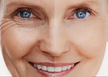 کلاژن چیست؟