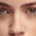 راه های پیشگیری و درمانهای خانگی و کلینیکی تیرگی زیر چشم