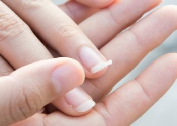 ۸ دلیل اصلی شکنندگی ناخن و روش های درمان ناخن های شکننده