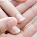 ۸ دلیل اصلی شکنندگی ناخن و روش های درمان ناخن های شکننده