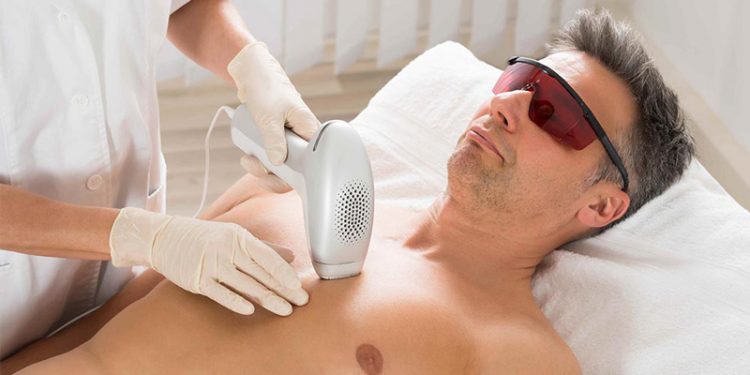 لیزر دائمی موهای زائد نیازمند دانستن چه نکاتی است؟