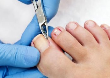 6 درمان طب سنتی برای تسکین سریع عفونت ناخن پا