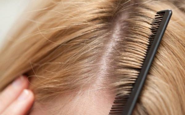 چگونه می توانیم سریع و ایمن موهای آسیب دیده دکلره شده را ترمیم کنیم؟