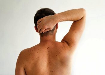 درمان های خانگی برای درمان و پاک کردن لکه های کبدی که عالی هستند