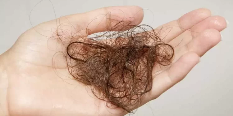 چگونه ریزش موی تیروئیدی را درمان کنیم؟