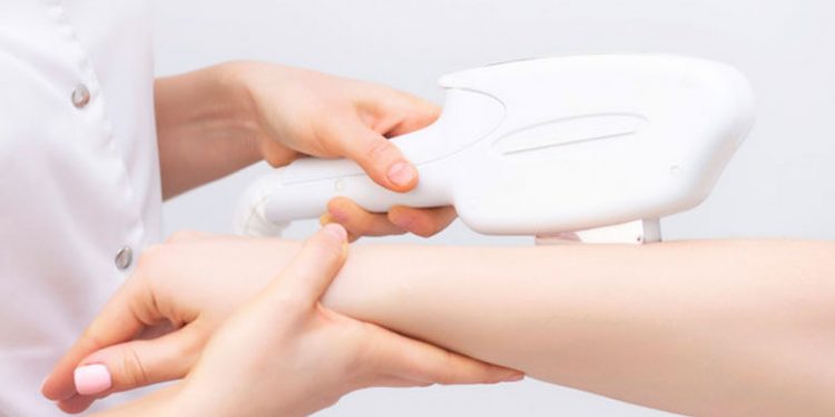 انواع دستگاه لیزر موهای زائد برای چه نوع پوست و مویی مناسب است؟