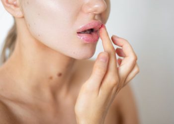 چگونه با روش های خانگی و بدون تزریق ژل، لب های برجسته طبیعی داشته باشیم؟