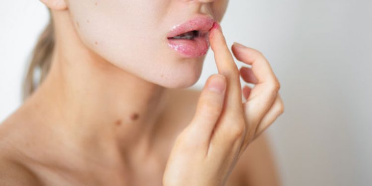 چگونه با روش های خانگی و بدون تزریق ژل، لب های برجسته طبیعی داشته باشیم؟