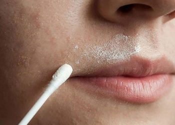 روش های موثر برای رفع موهای پشت لب با مواد گیاهی در منزل