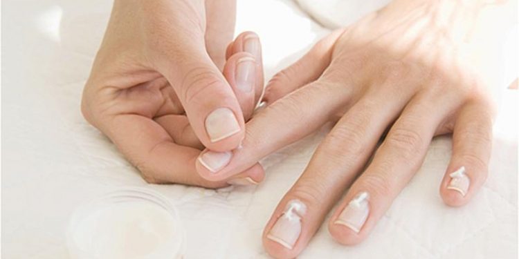 11 راهکار خانگی برای درمان پسوریازیس ناخن