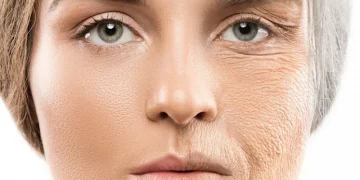۱۱ راه جلوگیری از پیری و چروک پوست