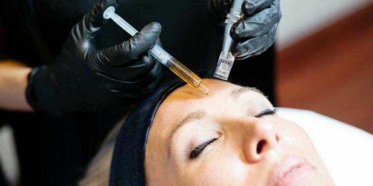 مزونیدلینگ صورت چیست؟