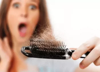 بررسی کامل انواع ریزش موی زنان + علت