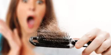بررسی کامل انواع ریزش موی زنان + علت