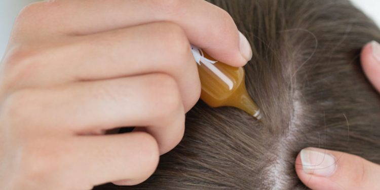 استفاده از تونیک مو و جلوگیری از ریزش مو