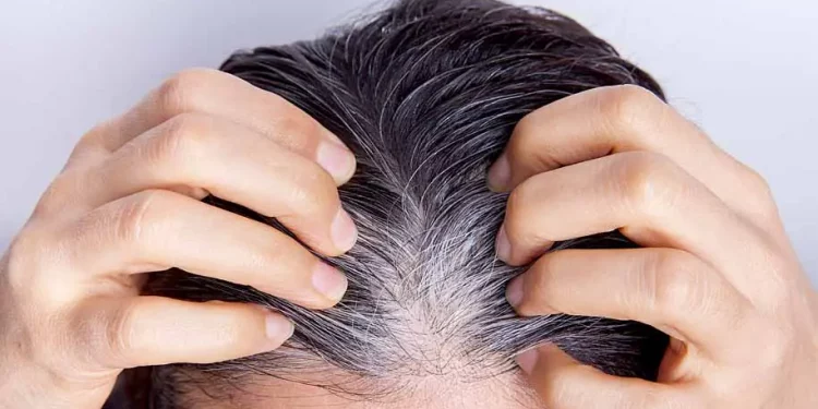 علت سفید شدن مو! چگونه از سفید شدن مو جلوگیری کنیم؟