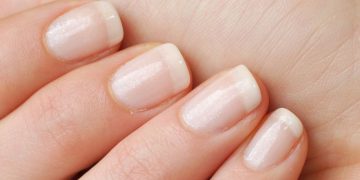 قارچ ناخن : علت و علائم آن چیست؟ چگونه قارچ ناخن را درمان کنیم؟