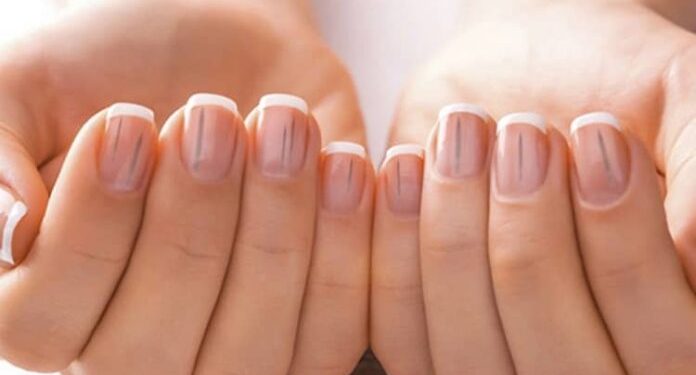 اختلالات ناخن