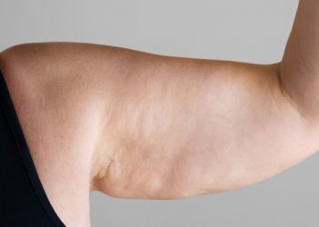 قاتل سلولیت چیست؟ چگونه از شر سلولیت خلاص شویم؟