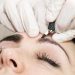 میکروبلیدینگ ابرو (فیبروز ابرو) برای چه کسانی مناسب نیست؟