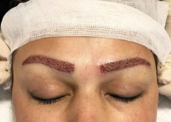 کاشت ابرو چگونه انجام می شود؟