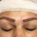 کاشت ابرو چگونه انجام می شود؟