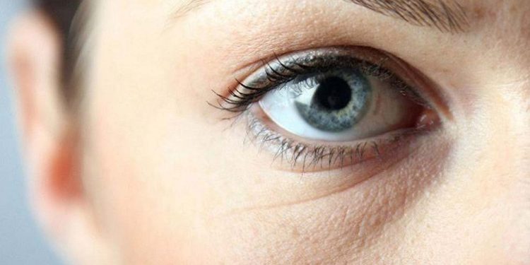 ازبین بردن سیاهی دور چشم با ۷ ماسک خانگی و طبیعی