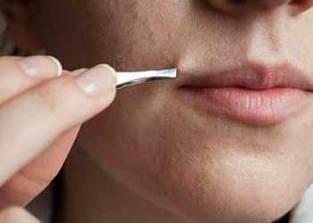 روش های موثر برای از بین بردن موی سبیل خانم ها