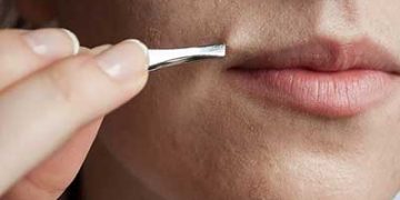 روش های موثر برای از بین بردن موی سبیل خانم ها