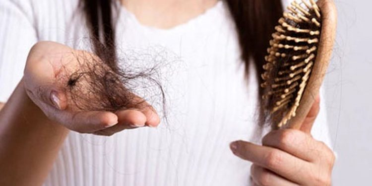 از ریزش مو خسته شده اید؟ این 14 نکته را برای جلوگیری از ریزش مو رعایت کنید