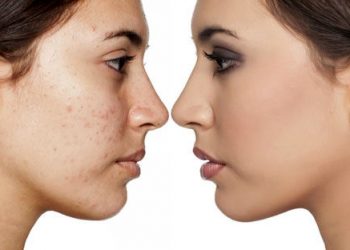 پانچ صورت چیست؟ و چه تاثیرات مثبت و منفی دارد؟