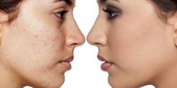 پانچ صورت چیست؟ و چه تاثیرات مثبت و منفی دارد؟