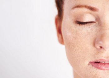 لکه پوست چیست؟ + علائم و درمان انواع لک پوست