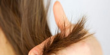 برای رفع موخوره چه باید کرد؟