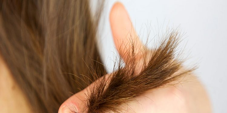 برای رفع موخوره چه باید کرد؟