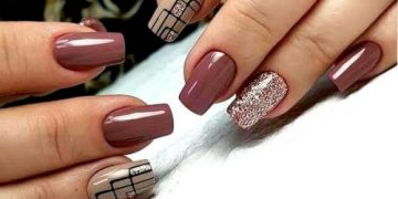 کاشت یا ژلیش؟ کدام را انتخاب کنم؟