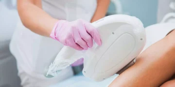 بهترین سن برای لیزر موهای زائد