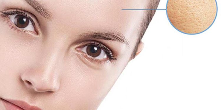 منافذ باز پوست و روش‌های درمان آن