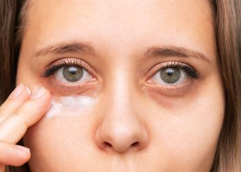 درمان گودی زیر چشم: علل، علائم و روش‌های رفع آن 