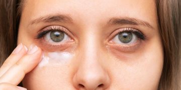 درمان گودی زیر چشم: علل، علائم و روش‌های رفع آن 