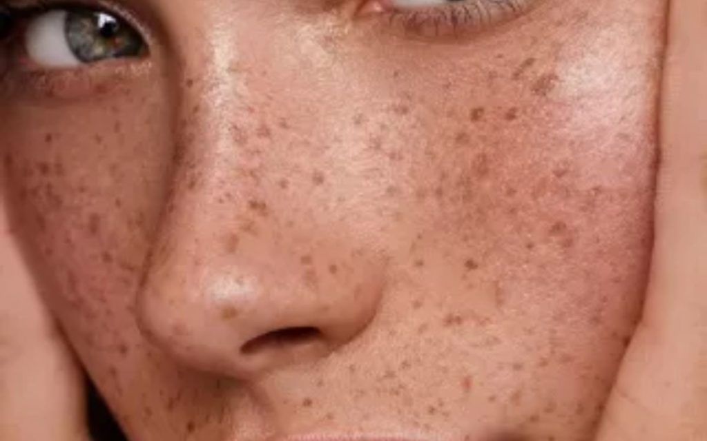 لک صورت