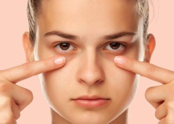 گودی و تیرگی زیر چشم: علل و راه‌های درمان